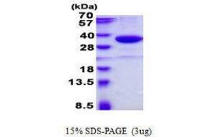 Figure annotation denotes ug of protein loaded and % gel used. (SMUG1 Protein)
