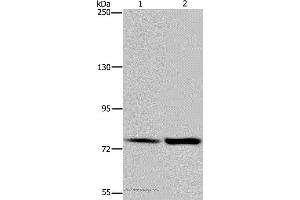 Western blot analysis of Hela and K562 cell, using GAB2 Polyclonal Antibody at dilution of 1:300 (GAB2 Antikörper)