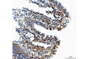 IHC analysis of XTP3TPA/DCTPP1 using anti-XTP3TPA/DCTPP1 antibody (ABIN7600677).