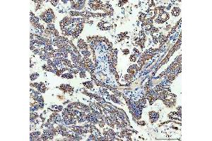 IHC analysis of TOMM20 using anti-TOMM20 antibody (ABIN7600883). (TOMM20 Antikörper  (AA 25-145))
