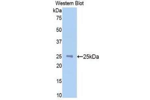 Western Blotting (WB) image for anti-N-Acetylgalactosaminidase, alpha (NAGA) (AA 218-415) antibody (ABIN1859956) (NAGA Antikörper  (AA 218-415))