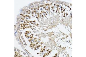 Immunohistochemistry of paraffin-embedded rat testis using PRDM14 Rabbit pAb (ABIN6128496, ABIN6146133, ABIN6146136 and ABIN6221189) at dilution of 1:100 (40x lens). (PRDM14 Antikörper  (AA 1-571))
