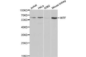 Western blot analysis of extracts of various cell lines, using MITF antibody (ABIN5970594) at 1/1000 dilution. (MITF Antikörper)