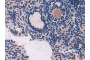 Immunohistochemistry (IHC) image for anti-Adenosine Kinase (ADK) (AA 1-361) antibody (ABIN7440812)
