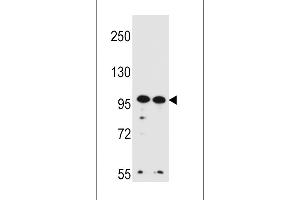 Western blot analysis in Hela,K562 cell line lysates (35ug/lane).