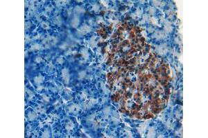 IHC-P analysis of Kidney tissue, with DAB staining. (iPLA2 Antikörper  (AA 481-702))