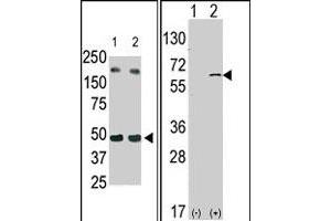 (LEFT) The SPHK1 polyclonal antibody  is used in Western blot (Lane 2) to detect c-myc-tagged SPHK1 in transfected 293 cell lysate (ac-myc antibody is used as control in Lane 1). (SPHK1 Antikörper  (N-Term))