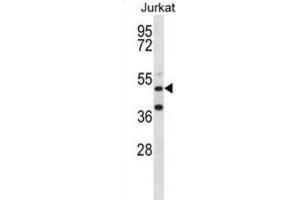 Western Blotting (WB) image for anti-RNA Binding Motif Protein 22 (RBM22) antibody (ABIN2998337) (RBM22 Antikörper)