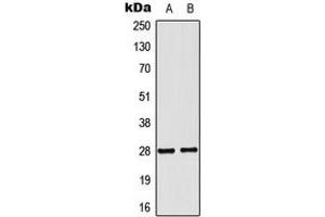 Western blot analysis of NKX2-6 expression in MCF7 (A), COLO205 (B) whole cell lysates. (NKX2-6 Antikörper  (Center))