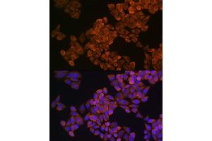 Immunofluorescence analysis of HeLa cells using SQLE Rabbit pAb (ABIN1513563, ABIN5664074, ABIN5664075, ABIN5664076 and ABIN6219540) at dilution of 1:100 (40x lens). (SQLE Antikörper  (AA 143-400))