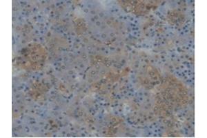 Detection of CYP17A1 in Rat Adrenal gland Tissue using Polyclonal Antibody to Cytochrome P450 17A1 (CYP17A1) (CYP17A1 Antikörper  (AA 201-507))
