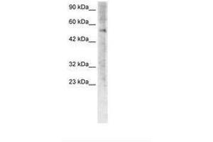 Image no. 3 for anti-Zinc Finger Protein 500 (ZNF500) (AA 348-397) antibody (ABIN6735775) (ZNF500 Antikörper  (AA 348-397))