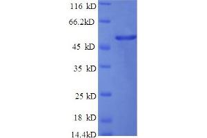 SDS-PAGE (SDS) image for Fibrinogen alpha Chain (FGA) (AA 36-218) protein (His tag) (ABIN5709513) (FGA Protein (AA 36-218) (His tag))
