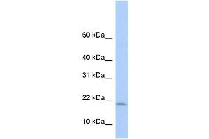POLR1D antibody used at 1 ug/ml to detect target protein. (POLR1D Antikörper)