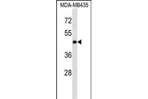 PK3 Antibody (ABIN1539804 and ABIN2843791) western blot analysis in MDA-M cell line lysates (35 μg/lane).