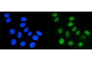 IF analysis of DHODH using anti-DHODH antibody (ABIN7603140). (DHODH Antikörper  (N-Term))