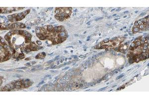 ABIN6279443 at 1/100 staining Human prostate tissue by IHC-P. (Gephyrin Antikörper  (Internal Region))