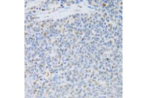 Immunohistochemistry of paraffin-embedded rat spleen using SFN Antibody. (14-3-3 sigma/SFN Antikörper  (AA 1-248))