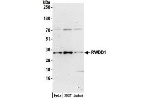 anti-RWD Domain Containing 1 (RWDD1) (AA 193-243) antibody