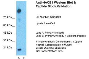 Host: Rabbit  Target Name: HACE1  Sample Tissue: Hela Whole cell  Lane A:  Primary Antibody Lane B: Primary Antibody + Blocking Peptide Primary Antibody Concentration: 1 µg/mL Peptide Concentration: 5 µg/mL Lysate Quantity: 41 µg/lane/LaneGel Concentration:.