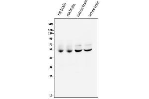 Western blot analysis of CaMKII alpha/CAMK2A using anti-CaMKII alpha/CAMK2A antibody (ABIN7599429).