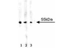 Western blot analysis of ALDH on A431 cell lysate. (Aldehyde Dehydrogenase Antikörper  (AA 7-128))