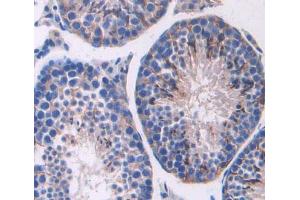 Used in DAB staining on fromalin fixed paraffin- embedded testis tissue (ABCC11 Antikörper  (AA 1127-1366))