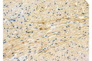 ABIN6264749 and ABIN6277838 at 1/100 staining Rat heart tissue by IHC-P.