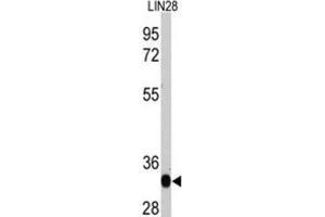 Western Blotting (WB) image for anti-Lin-28 Homolog A (C. Elegans) (LIN28A) antibody (ABIN2995304)