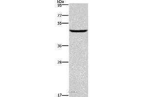 Western blot analysis of Human testis tissue, using DMRT3 Polyclonal Antibody at dilution of 1:550 (DMRT3 Antikörper)
