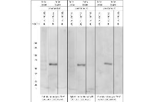 Effect of denaturing temperature on Western blot on brain lysates using Rabbit antibody to ChAT (70-120): . (Choline Acetyltransferase Antikörper)