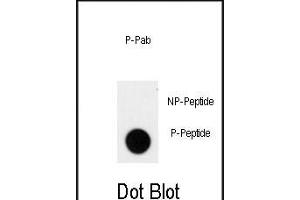 Dot blot analysis of anti-Phospho-ACK1-p Phospho-specific Pab (ABIN650839 and ABIN2839804) on nitrocellulose membrane. (TNK2 Antikörper  (pTyr826))