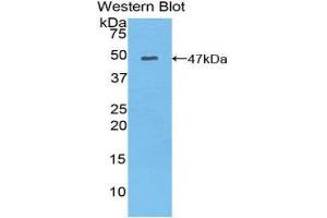 Western Blotting (WB) image for anti-Myosin, Light Chain 6B, Alkali, Smooth Muscle and Non-Muscle (MYL6B) (AA 6-137) antibody (ABIN1859943)