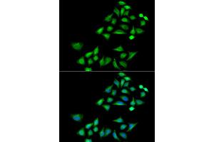 Immunofluorescence analysis of A549 cells using KLK4 antibody (ABIN5973996). (Kallikrein 4 Antikörper)
