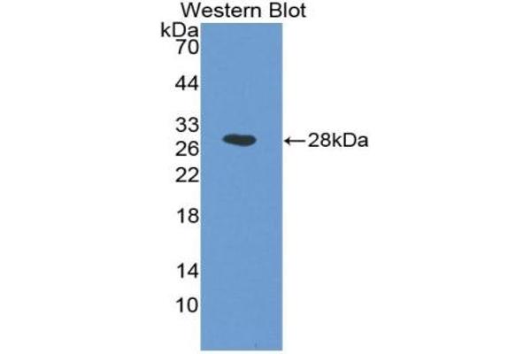 ICAM2 Antikörper  (AA 29-247)