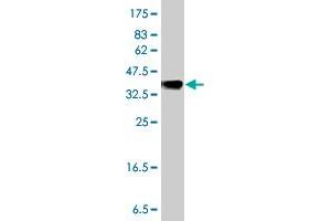 Western Blot detection against Immunogen (36. (MGAT5 Antikörper  (AA 642-739))