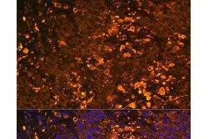 Immunofluorescence (IF) image for anti-UDP Glucuronosyltransferase 1 Family, Polypeptide A1 (UGT1A1) antibody (ABIN7262012)