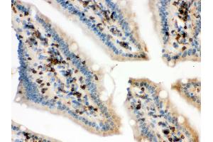 Anti- Cofilin Picoband antibody, IHC(P) IHC(P): Mouse Intestine Tissue (Cofilin Antikörper  (C-Term))