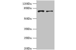 Western blot All lanes: GBE1 antibody at 3. (GBE1 Antikörper  (AA 1-300))