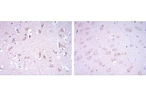 Immunohistochemical analysis of paraffin-embedded human brain tissues (left) and rat brain tissues (right) using GRIA3 mouse mAb with DAB staining.