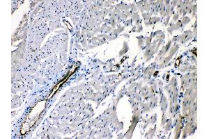 ANGPTL2 was detected in paraffin-embedded sections of rat cardiac muscle tissues using rabbit anti- ANGPTL2 Antigen Affinity purified polyclonal antibody (Catalog # ) at 1 µg/mL. (ANGPTL2 Antikörper  (Middle Region))