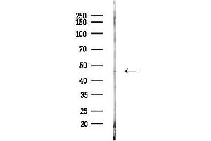 Western blot analysis of lysates from LoVo cells(heat-shock,45 min treatment), using IKZF5 Antibody at 1/1000 dilution.