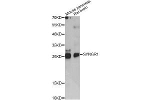 Western blot analysis of extracts of various cell lines, using SYNGR1 antibody (ABIN6290976) at 1:1000 dilution. (Synaptogyrin 1 Antikörper)