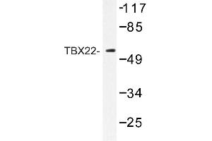 Image no. 1 for anti-T-Box 22 (TBX22) antibody (ABIN272263) (T-Box 22 Antikörper)
