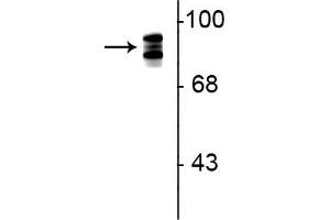 Western blot of rat lung lysate showing specific immunolabeling of the ~93 kDa periostin protein triplet. (Periostin Antikörper)