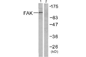 Western blot analysis of extracts from Jurkat cells untreated or treated with anti-CD3 antibody,using FAK (Ab-397) antibody (#B7081, Linand 2). (FAK Antikörper  (Tyr397))