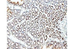 IHC analysis of MCM2 using anti-MCM2 antibody (ABIN7601593).