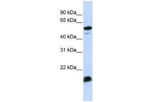 C4BPA antibody used at 1 ug/ml to detect target protein.