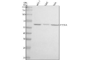 Western blot analysis of PPP3CA using anti-PPP3CA antibody (ABIN7604191).