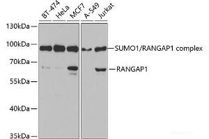 Western blot analysis of extracts of various cell lines using RANGAP1 Polyclonal Antibody at dilution of 1:1000.